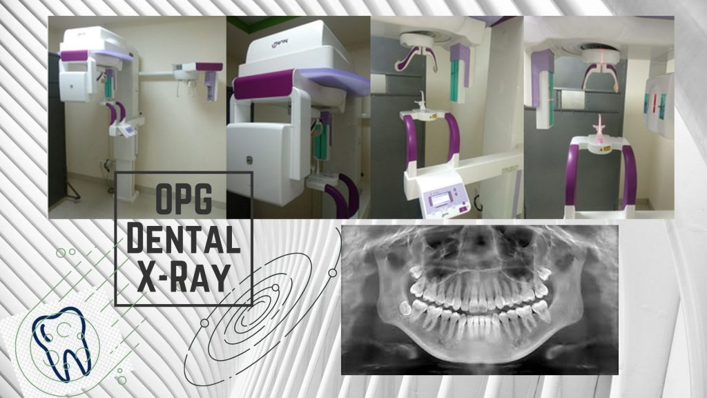 OPG Dental X-Ray