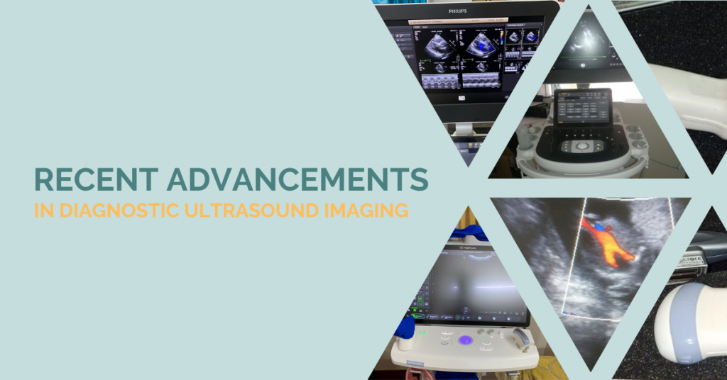 Recent Advancements in ultrasound imaging