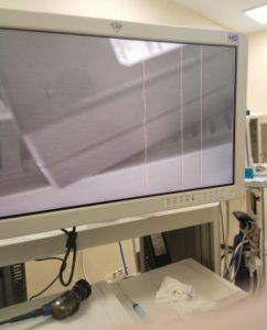 surgical camera image issues