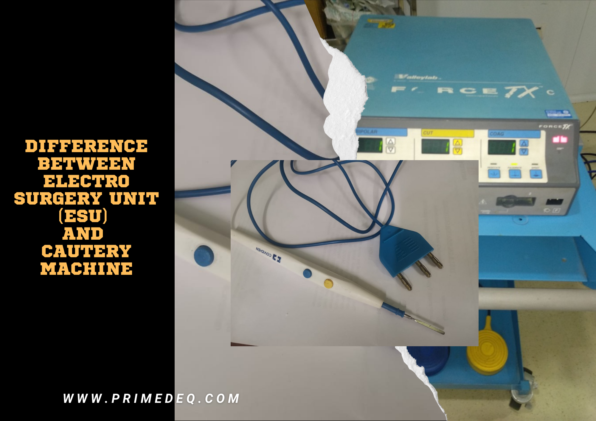 Difference Between Electro Surgery Unit ESU Cautery Machine difference-between-electro-surgery-unit-esu-cautery-machine