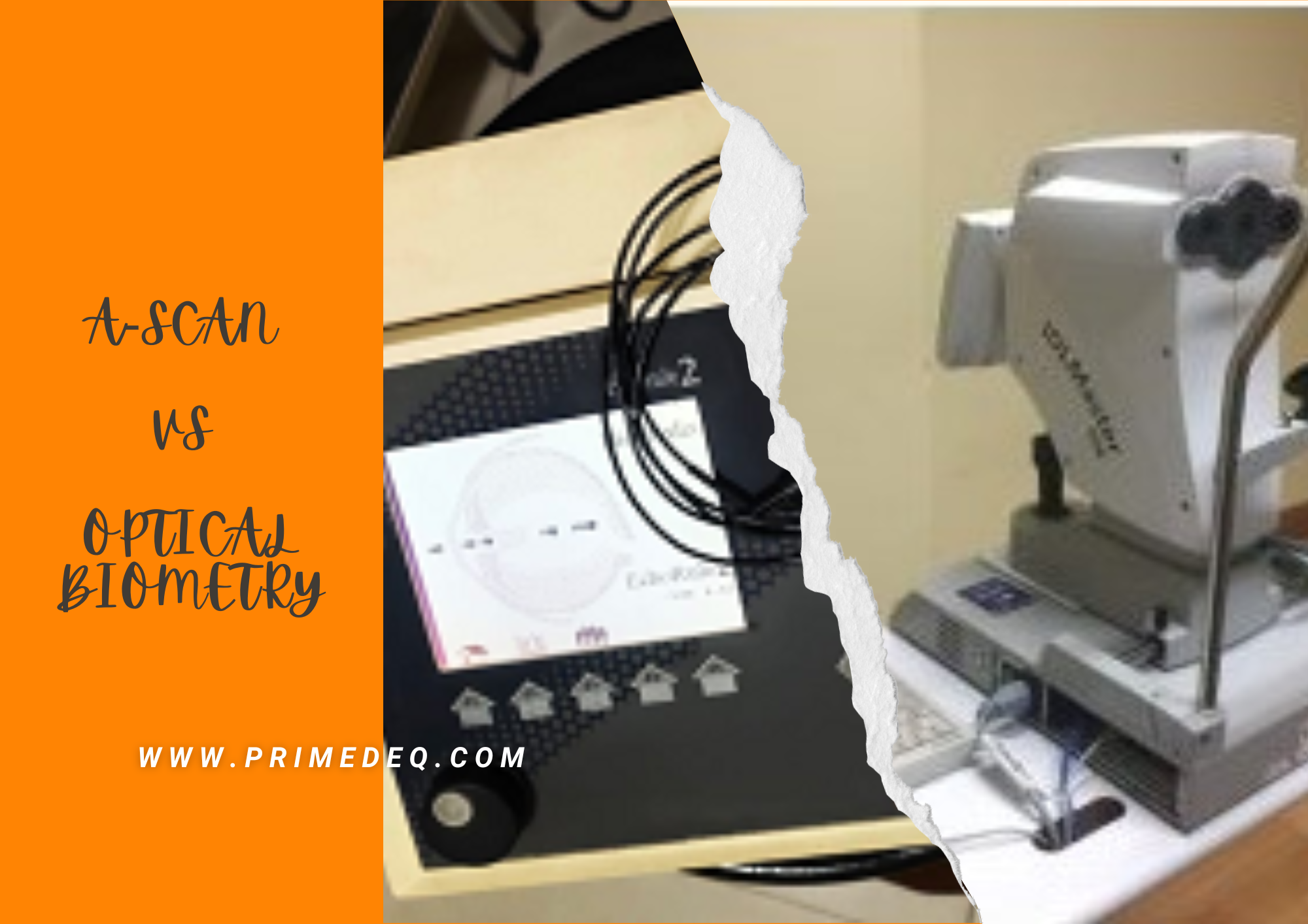 Ultrasound AScan vs Optical Biometry A Comparison PrimedeqBlog