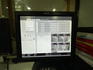 Heamodynamics Monitor