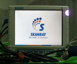 Skanray Patient Monitor Star 60 with ETCO2