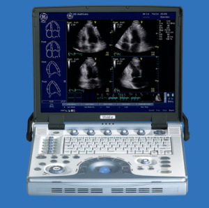 GE  Vivid e Portable Ultrasound