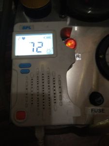 BPL Foetal Doppler FD 9713N