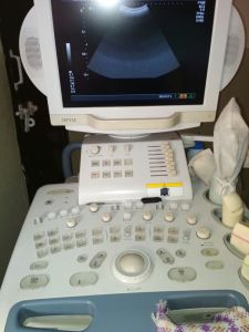 Toshiba Ultrasound Machine Nemio X6 sonography, ultrasound scan scanning machine, toshiba nemio nemio x6