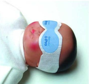 Medical Neonatal Eye protector (Pack of 50)