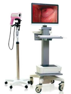 Sunshine Digital Colposcope Vision 300