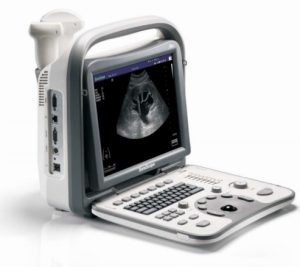 Pre-Owned Sonoscape A 6 Ultrasound machine, Ultrasound machine, used usg, used ultrasound, online used ultrasound, sonoscape ultrasound machine, a6 ultrasound, buy sell medical equipment, primedeq, medical equipment marketplace,medical equipment, e-market
