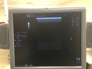 GE Logiq 7 Ultrasound Machine