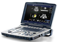 GE Logiq V2 Ultrasound Machine