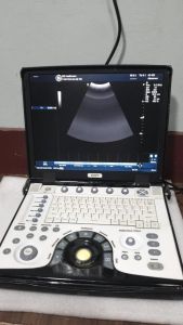 Ge Vivid E Portable Ultrasound Machine,Ultrasound Machine,Vivid E,ge,buy,sell,rent,Cardiovascular, Refurbished. 