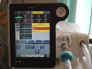 Philips Respironics V680 Ventilator