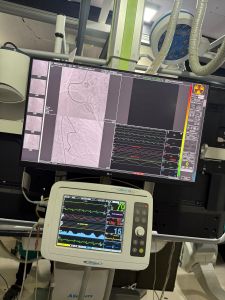 Allengers Life FP Cath lab